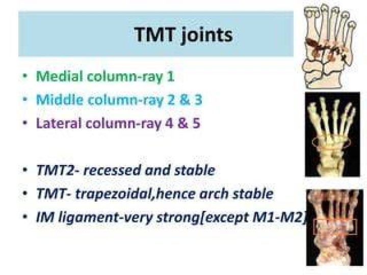 TMT-2